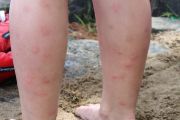 To Do List....Buy Bug Spray (Greg Sladics) To Do List....Buy Bug Spray (Greg Sladics)